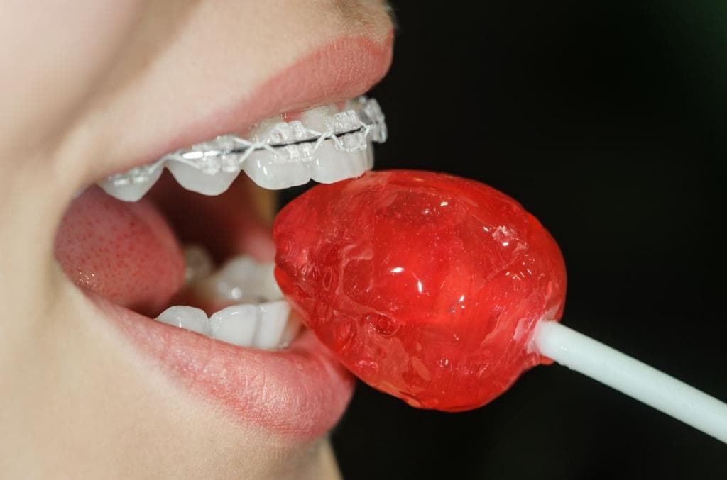Adaptando la dieta a la ortodoncia
