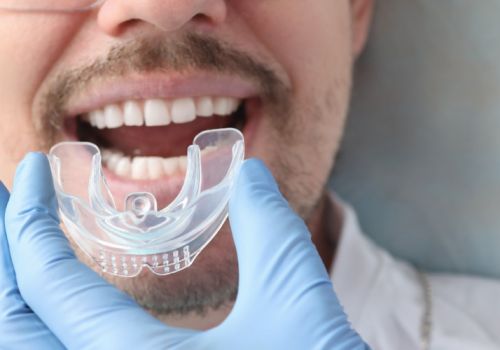 ATM y bruxismo Imagen ATM y bruxismo