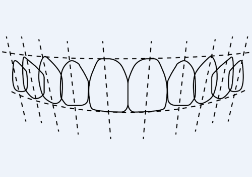 Diseño de la sonrisa Imagen Diseño de la sonrisa