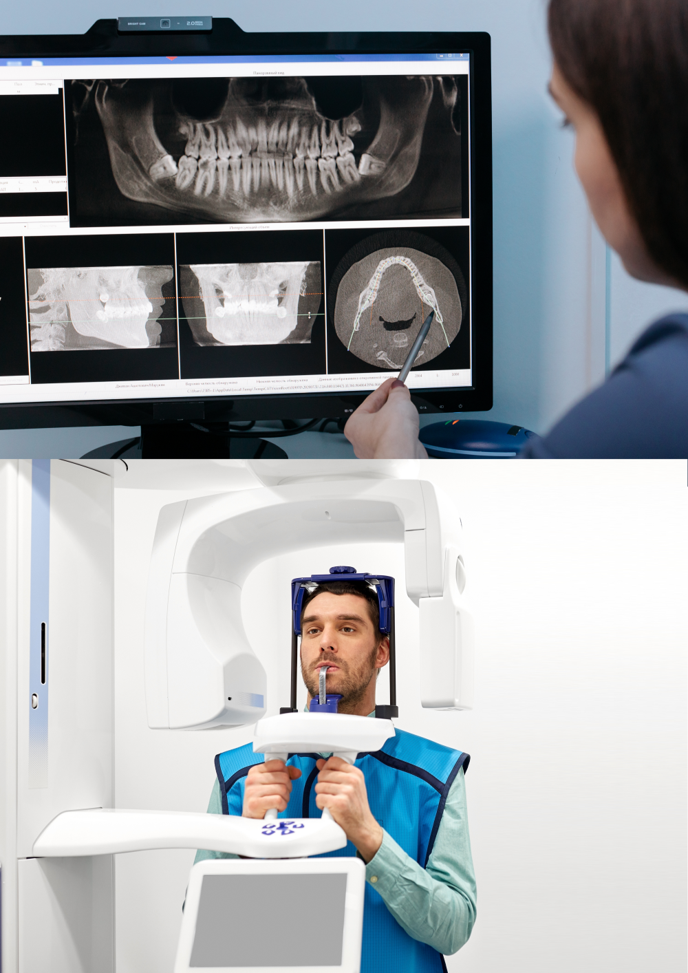 CBCT (TAC dental en 3D) CBCT (TAC dental en 3D)