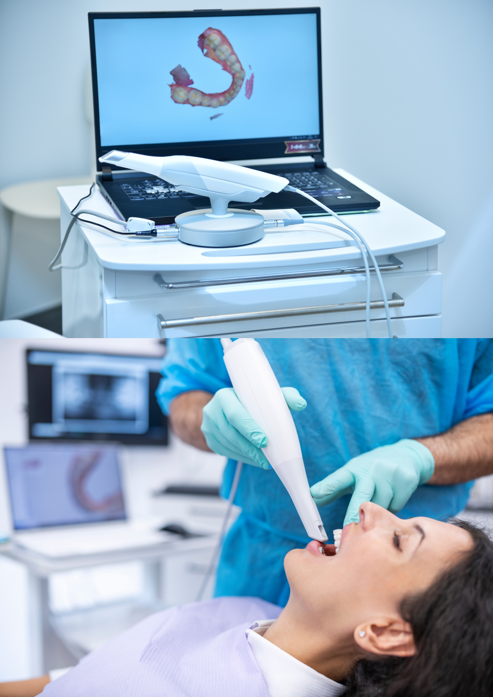 Escáner intraoral Escáner intraoral