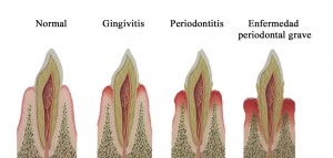 periodoncia imagen 2